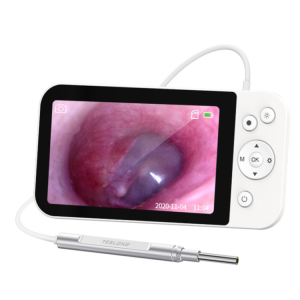 Telstar MS500 5" HD Large Screen Illuminated Ear Spoon 3.9mm Diameter Visual Ear Collection Tool // Telstar MS450 4.5" HD Smart Screen Otosc
