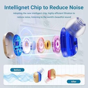 XIYNBH Hearing Aids, Rechargeable Hearing Aids